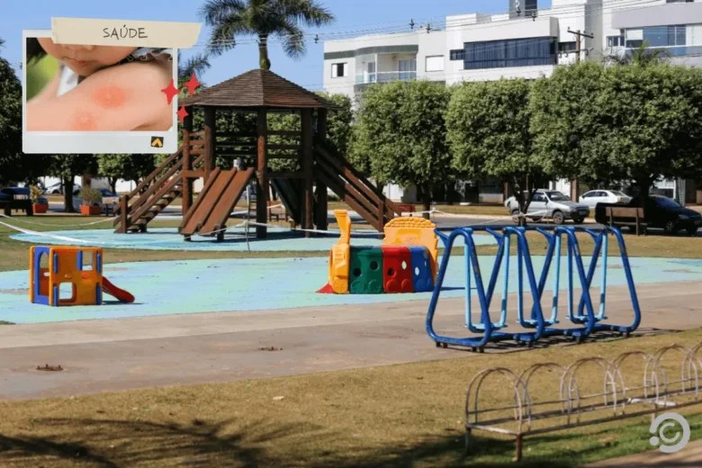 Laudo preliminar aponta ácaro de aves como causa de alergias em praças de Lucas do Rio Verde